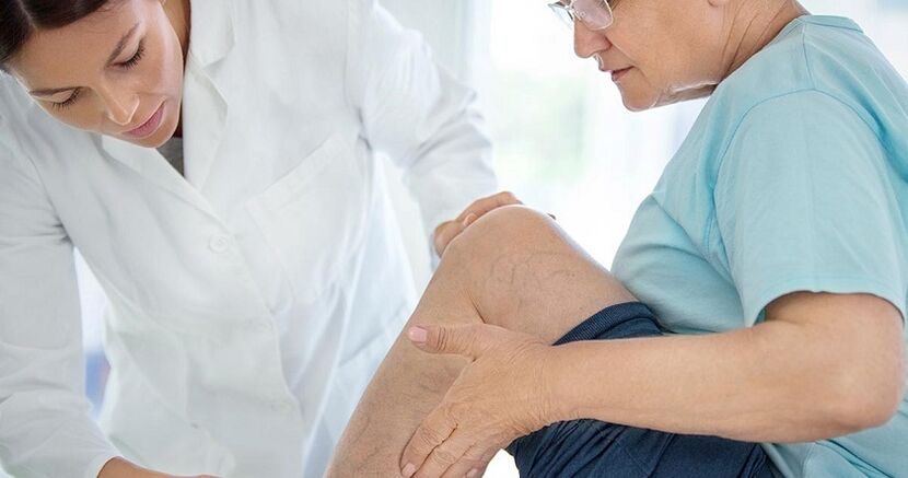 Des varices sont observées à chaque deuxième personne