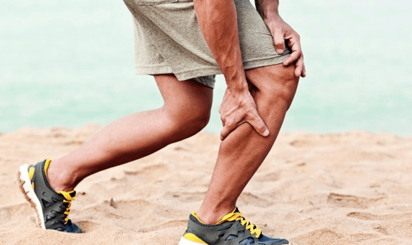 Signes de varices