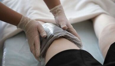 Méthodes populaires pour traiter les varices chez les femmes