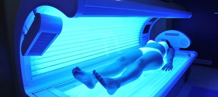Varices et solarium